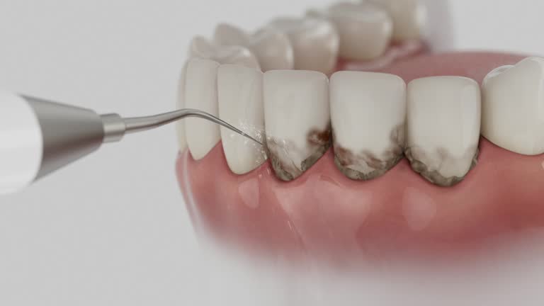 Reliable Dental contractor in Tomah, WI by Smile Center Dentistry